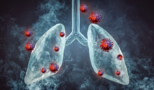 What Is Lung Cancer?