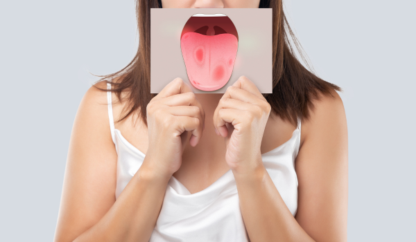 Tongue Cancer: Causes, Symptoms, Diagnosis, and Treatment