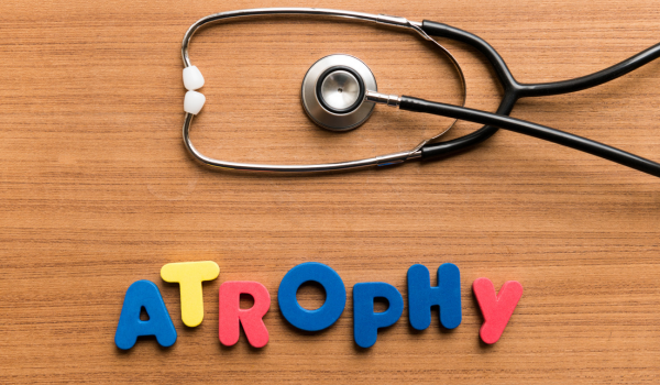 What Is Geographic Atrophy?