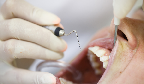 The Link Between Oral Health and Heart Disease: What the Science Says