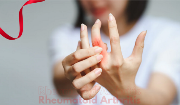 What Is Rheumatoid Arthritis?