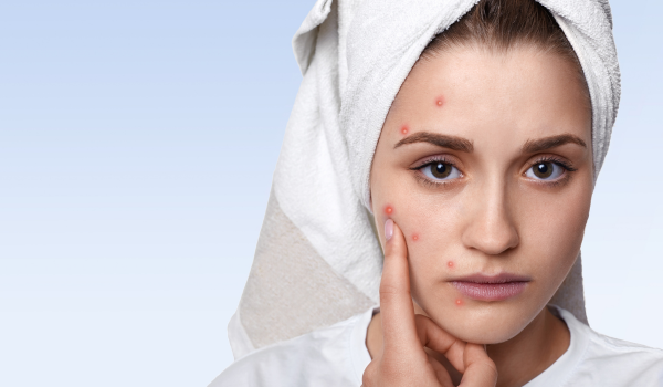 What Is a Skin, Hair, and Nail Condition?