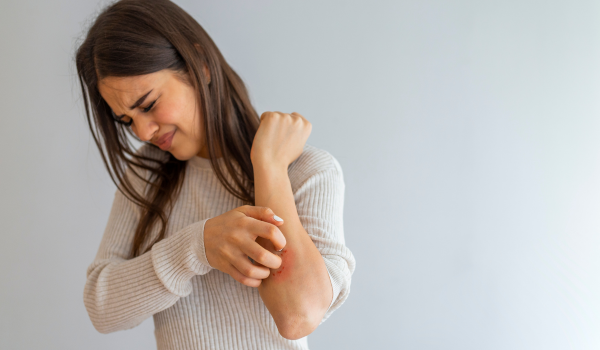 What Is Psoriasis? Everything You Need To Know