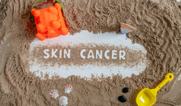 What Causes Skin Cancer? Common Risk Factors You Should Know