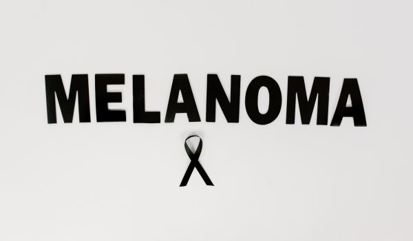 Melanoma Stages Explained: What Each Stage Means for Treatment