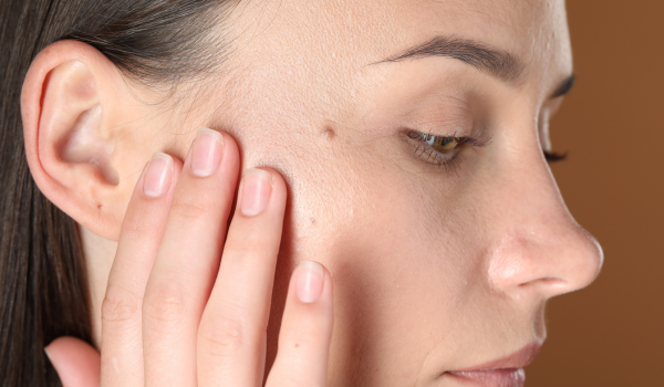 Understanding Melanoma Prognosis and Survival Rates