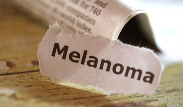 Living with Melanoma: Coping Strategies and Emotional Support
