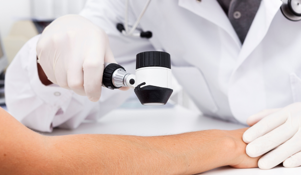 Emerging Treatments and Research Advances in Melanoma