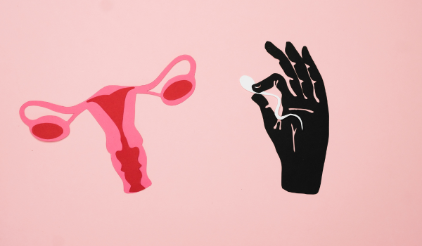 Understanding Polycystic Ovary Syndrome (PCOS): Causes, Symptoms, and Treatment