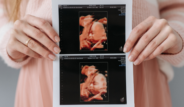 Understanding the Cost of an IUD